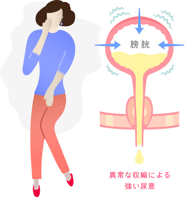過活動膀胱の症状イメージ